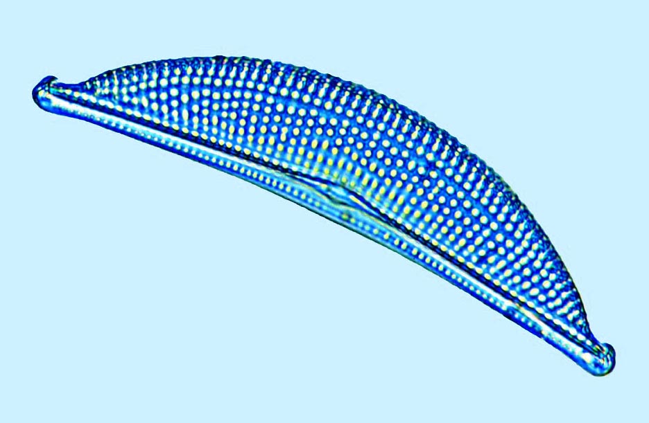 Amphora Amphora costata